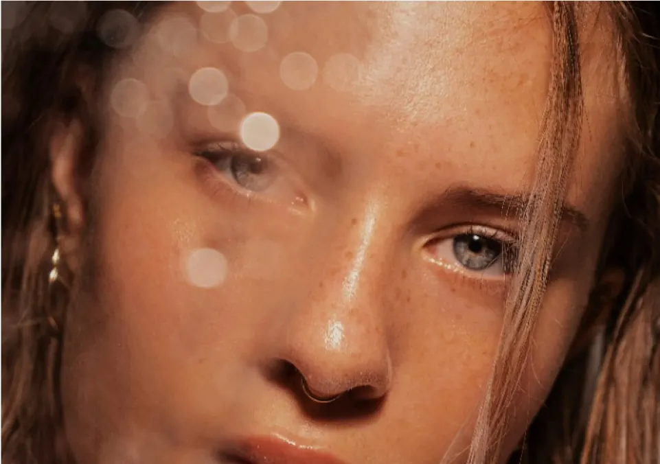 Detalle de piel real con pecas y fondo suave